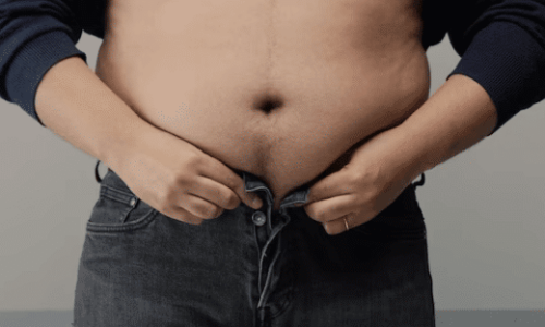 Rischi legati al sovrappeso e obesità